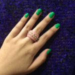Ring تقويم الاسنان - Image 2